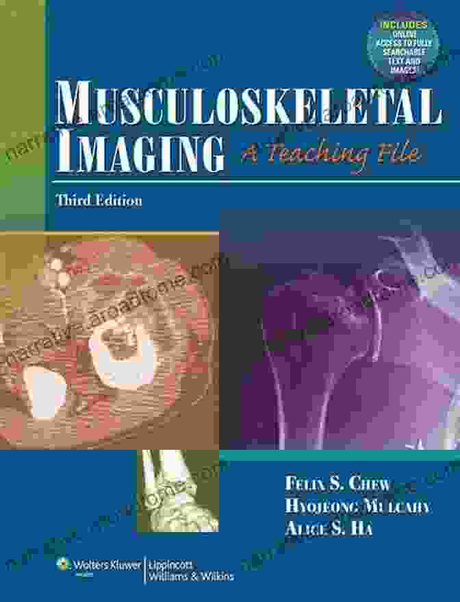 Book Cover Of Musculoskeletal Imaging By Felix Chew Musculoskeletal Imaging: The Essentials Felix S Chew