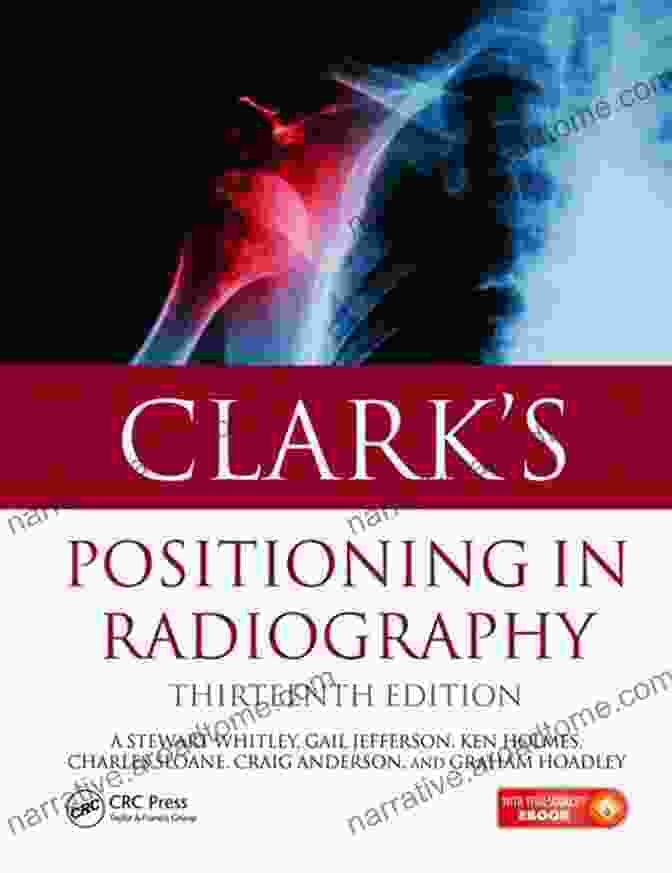 Cover Of Clark Positioning In Radiography 13e Clark S Positioning In Radiography 13E