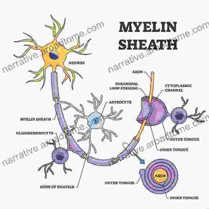 Healthy Myelin Sheath The Strange Case Of The Missing Myeline (decoding Multiple Sclerosis)