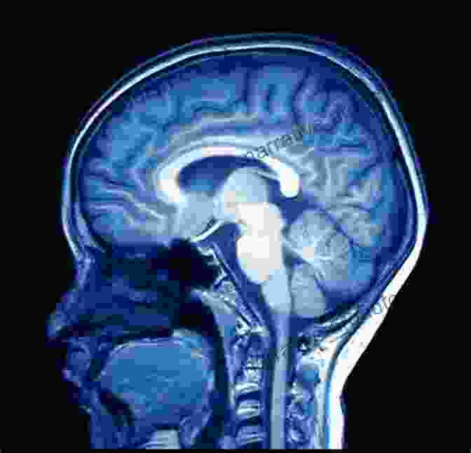 High Quality MRI Image Of The Human Brain MRI For Radiographers Philip T English