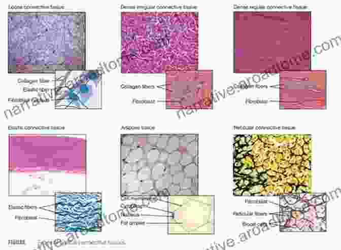 Histology Chapter 3: Connective Tissue Matrix Histology For Pathologists