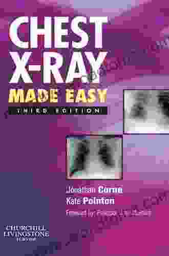 Chest X Ray Made Easy E