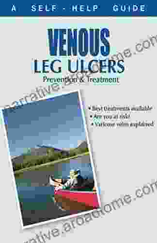 The Doctor S Guide To: Venous Leg Ulcer (Dr Guide Books)